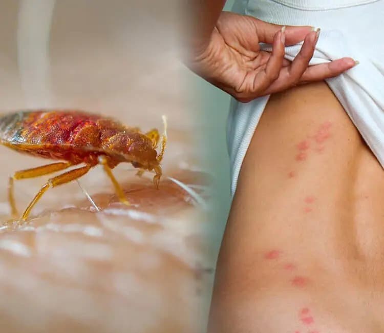 Same-day Bed Bug Exterminator at Pest Control Pro
